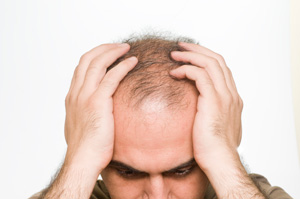 Can a Pfizer Rheumatoid Arthritis Pill Grow Hair?